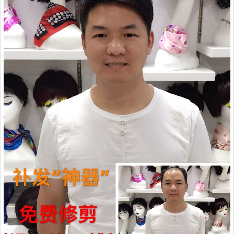 全手织真人发假发片男款高端头顶补发发块新递针隐形逼真短增补发