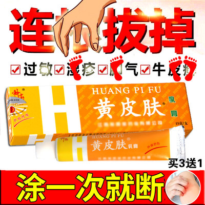 正品黄皮肤乳膏，以帮助10万人