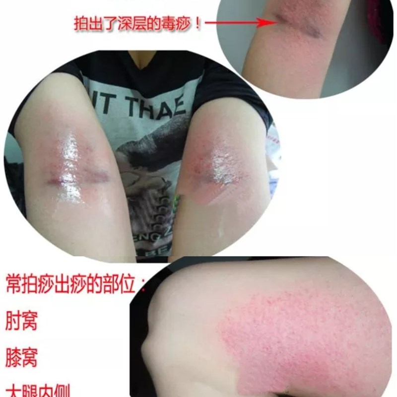 拍痧板硅胶经络拍打拍拍棒肩颈敲打按摩健身锤腿拍养生专用2只装