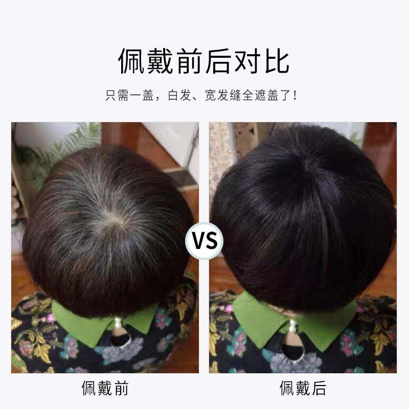 头顶真发补发片老人盖白发递针轻薄款全真人发短发假发片女遮秃顶