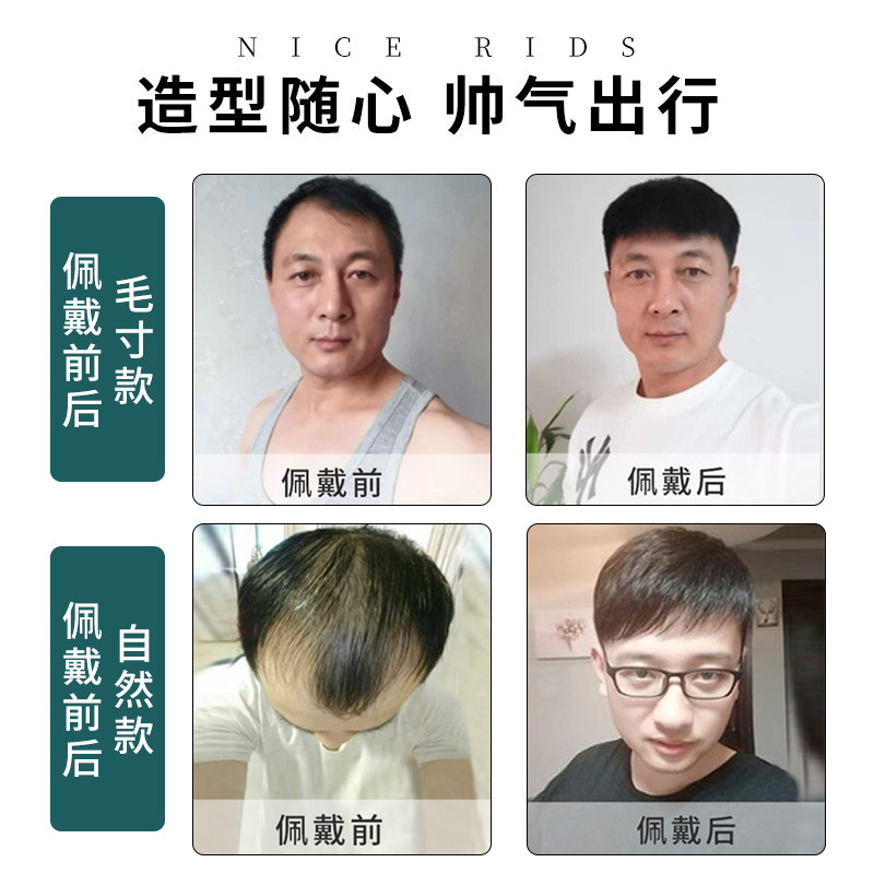 假发男短发遮盖头顶白发补发片轻薄透气短直发秃顶前额男士假发块