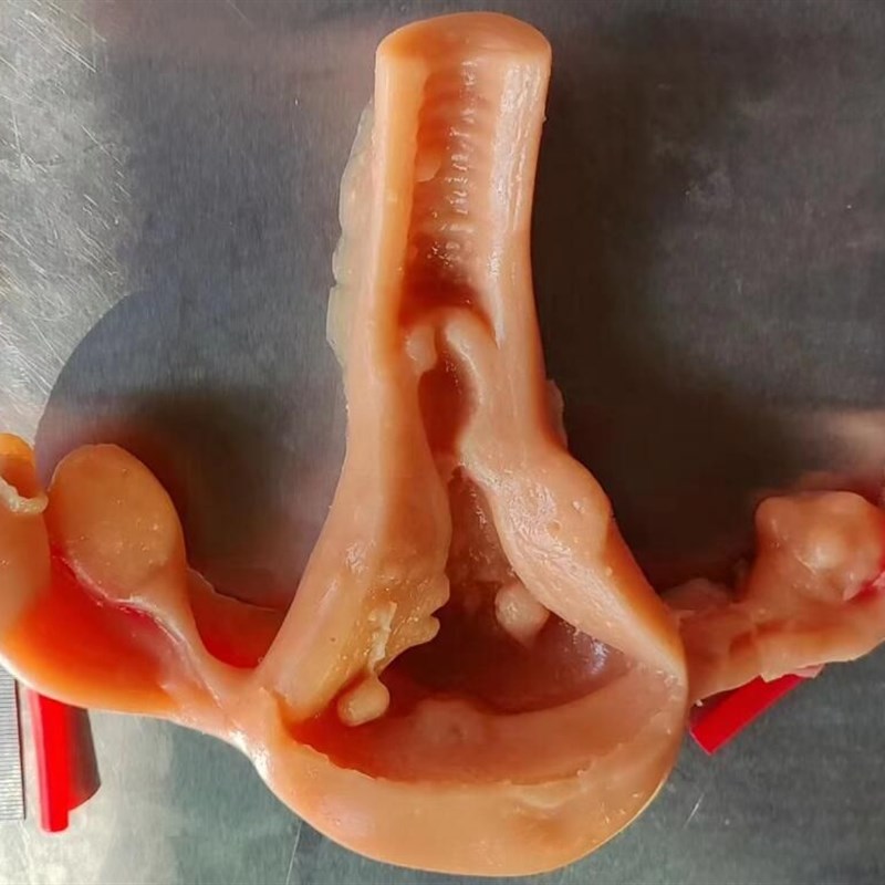 妇科腹腔镜剪切缝合剥离练习3D仿生模块