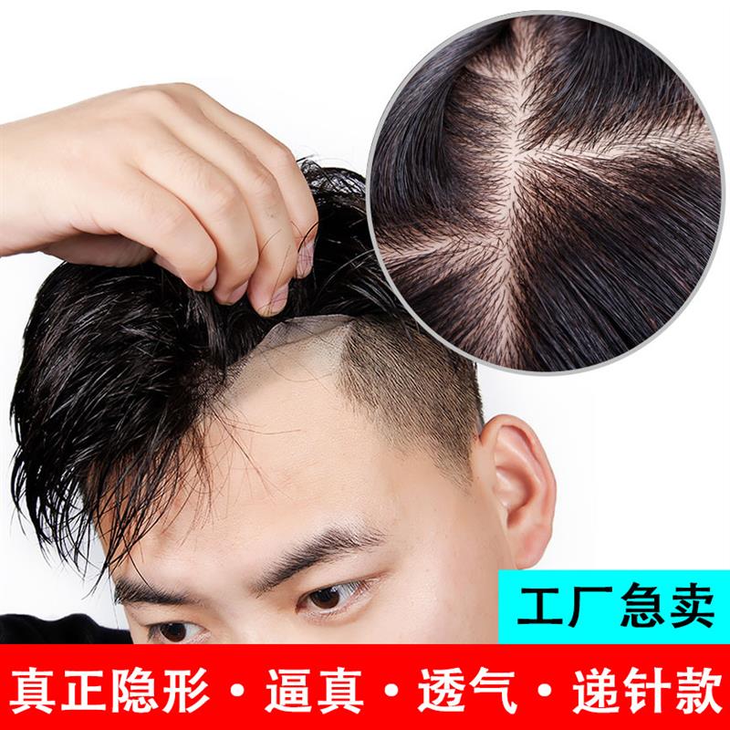 男士真发双递针头顶补发片仿真头皮高端假发男前额无痕隐形假发片