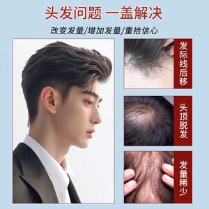 假发男士背头短发隐形补发片自然蓬松头顶假发片全真人发轻薄透气