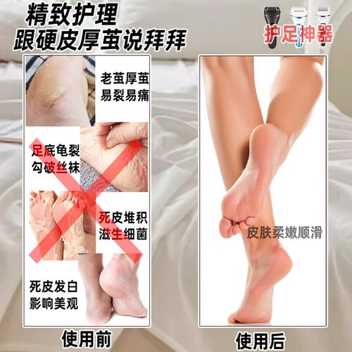 电动磨脚器去死皮老茧脚后跟修足2024新款自动修脚皮打磨护理神器