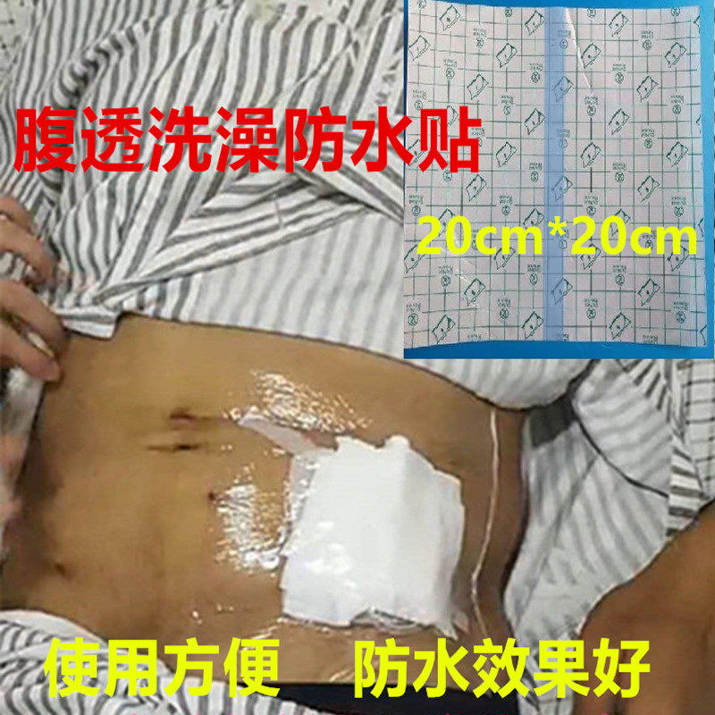 50张包邮腹膜透析洗澡袋腹透洗澡防水贴pu保护膜腹透用品20*20cm