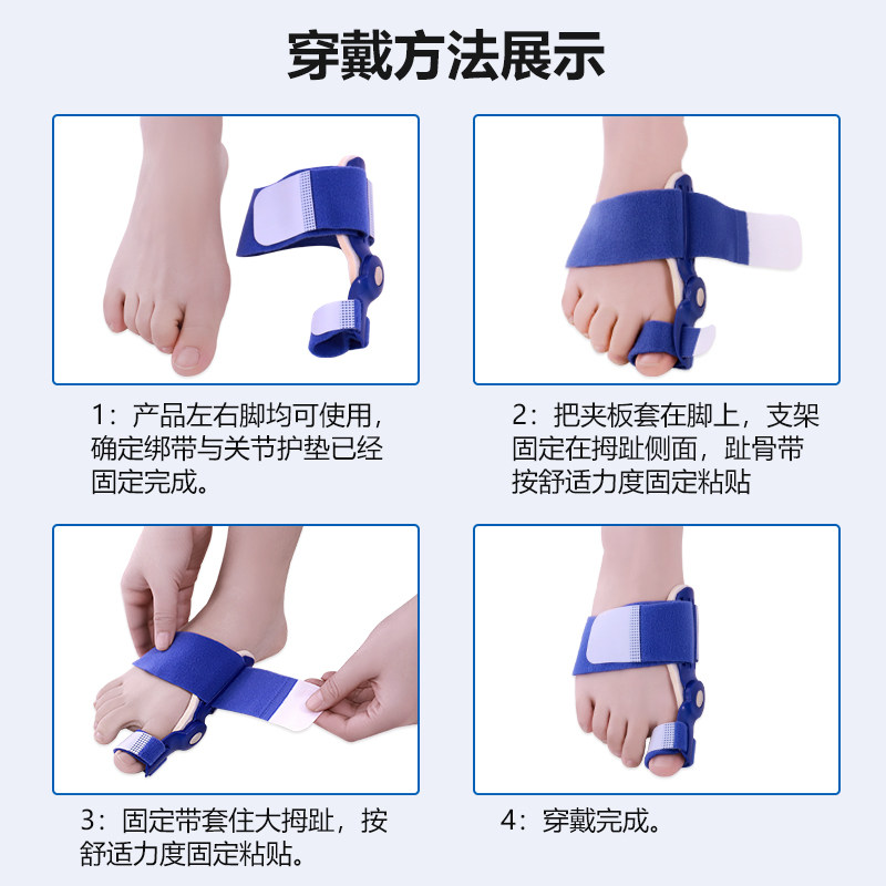拇指外翻矫正器拐骨脚趾内翻矫形大脚骨母趾头男女纠正带可以穿鞋
