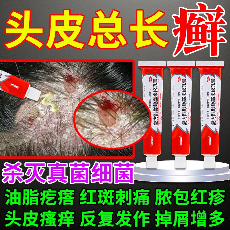 头屑头痒头皮癣专用药膏脂溢性皮炎黄癣结痂白癣掉鳞屑油脂疙瘩