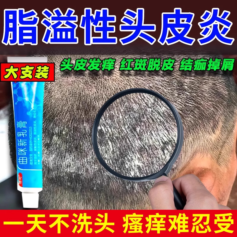 头皮屑脂溢性皮炎真菌感染头癣头皮毛囊炎专用药膏曲咪新乳膏正品