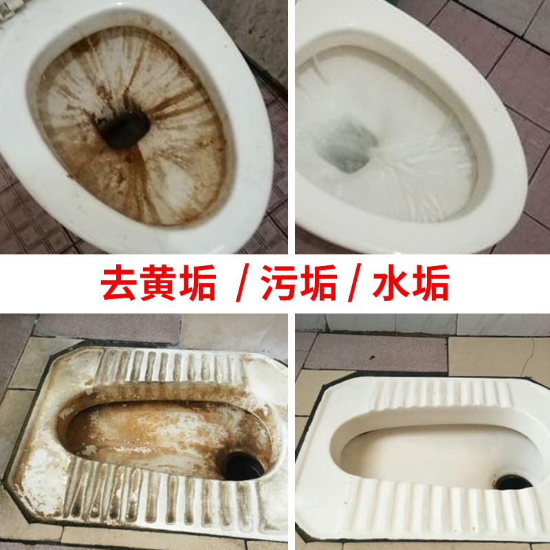 洁厕液灵净马桶强力清洗除垢神器家用厕所尿碱除黄渍去臭味清洁剂