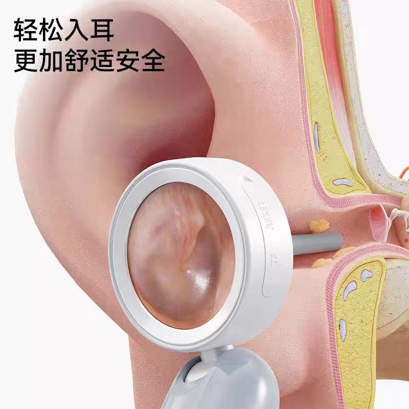 高清耳道内视镜智能可视耳镜电耳镜耳鼻喉检耳镜科宠物儿童窥耳镜