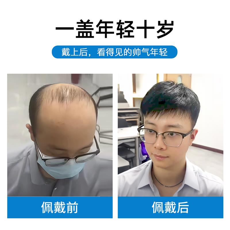 男士假发短发全真发自然轻薄毛寸头顶补发块透气无痕日常假发男款