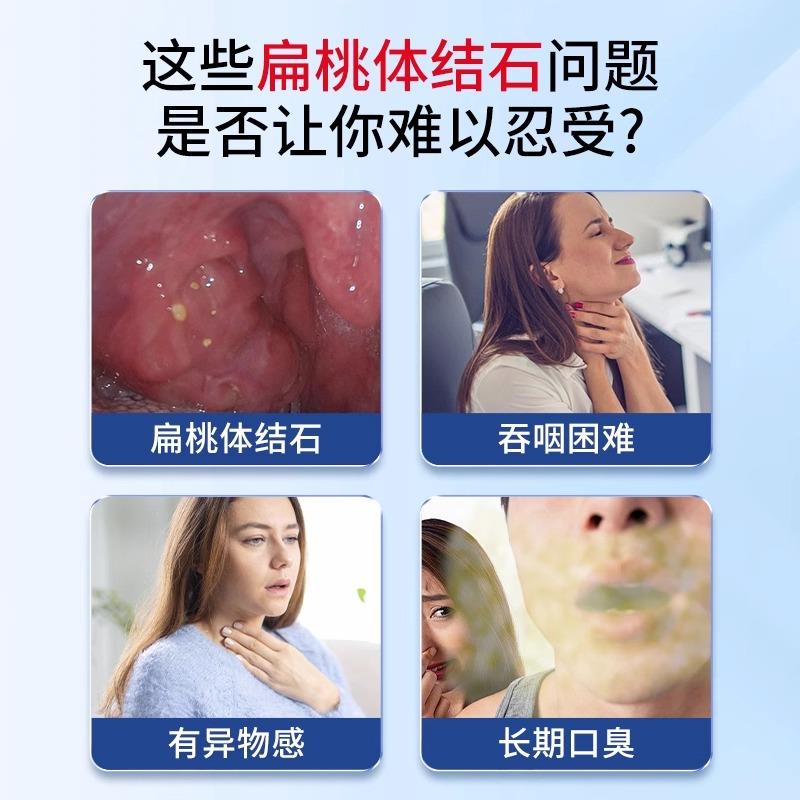 扁桃体结石去除喷剂清洁工具隐窝喷雾冲洗器电动吸取器吸出漱口水