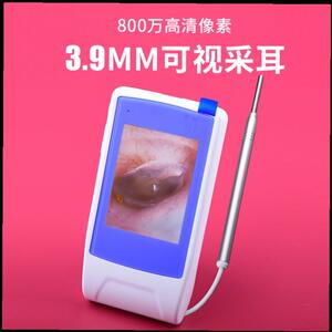高清可视挖耳勺检测耳鼻喉内窥镜耳朵清洁扣耳勺采耳工具掏耳朵