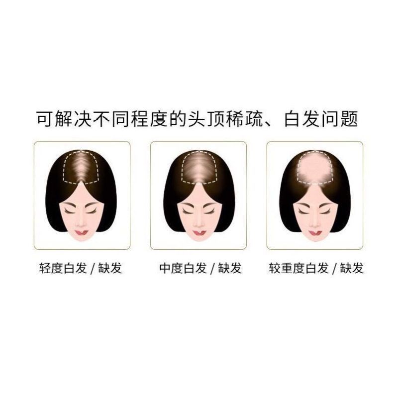 假发卷发小卷假发真头发羊毛卷可水洗额头蓬松假发片头顶中老年