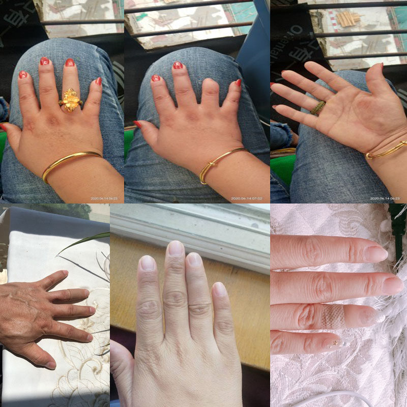 防护进口硅胶手指假肢美容手套仿真脚趾套美甲半指残疾人逼真义肢