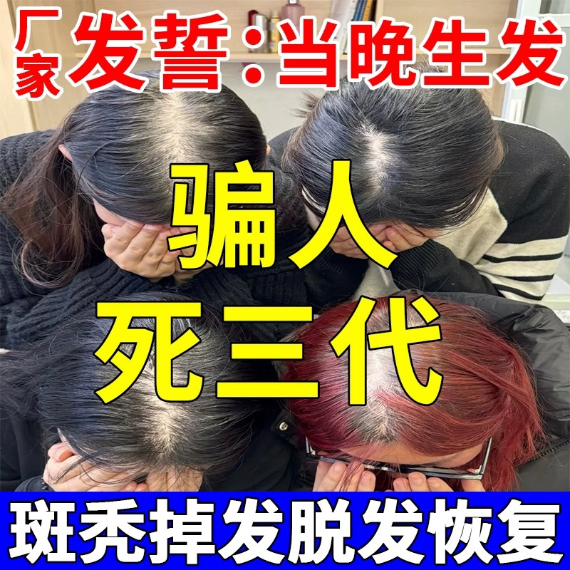 头发生长液斑秃鬼剃头专用液防脱育发生长液快速增发密发护生发剂