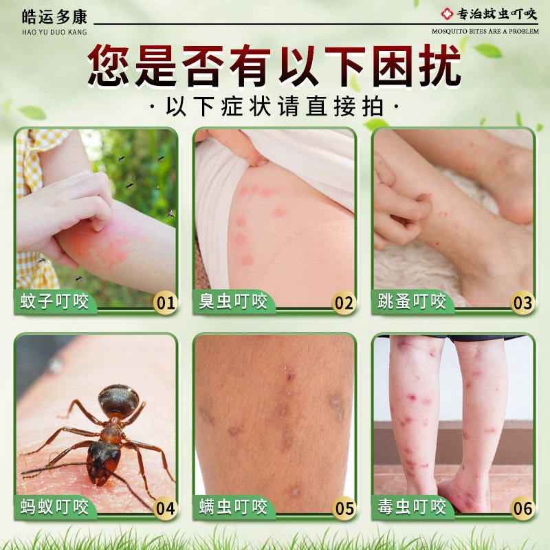 蚊虫叮咬快速痒止膏药婴幼儿童宝宝专用消蚊子包痒止炎神器