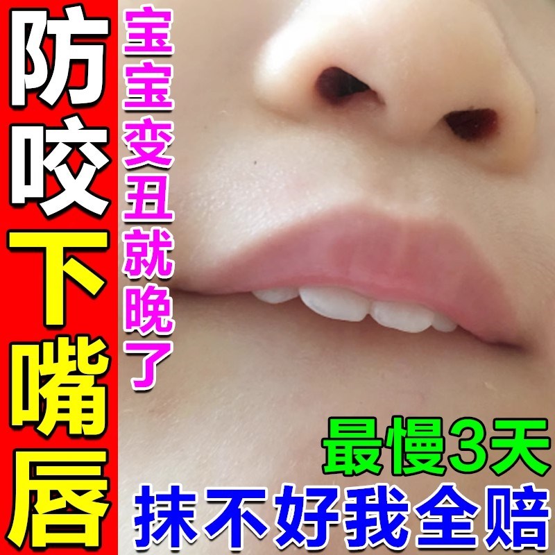 防咬下嘴唇神器小孩矫正器防止宝宝口呼吸儿童凸嘴舔吸手指苦瓜水
