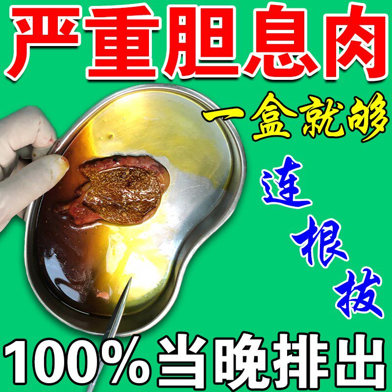胆囊息肉中药胆结石多发息肉中药贴溶石化石排石调理茶特效专用药
