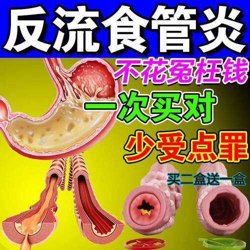治胃食管反流炎性胃胀气打嗝嗳气胆汁胃炎调理茶胃烧心反酸保健贴