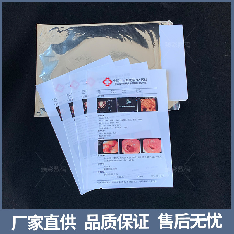 B超打印纸胃镜胶片四维胶片彩超瓷激光喷墨胶片胶片胶片白唛纸头