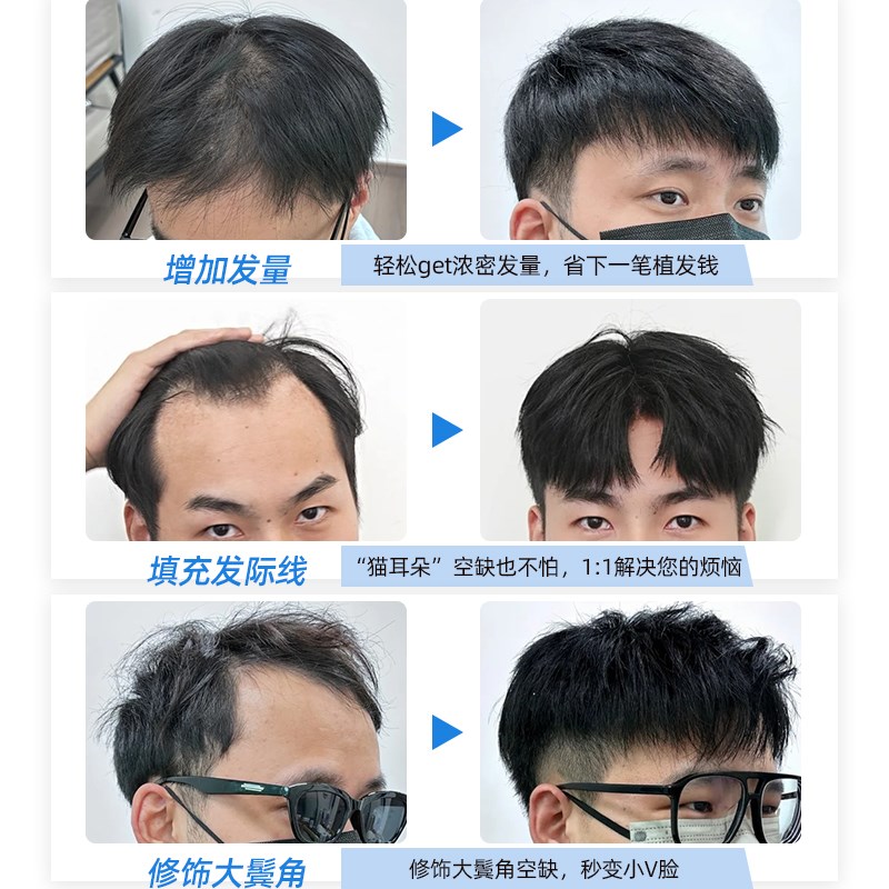发际线假发贴男士前额全真发m型假刘海轻薄自然遮盖无痕补发贴片