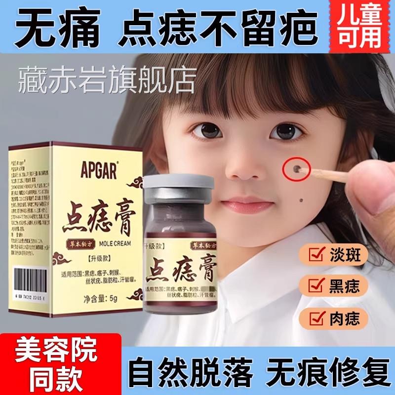 去痣点斑痣膏无痕正品非药水脸部专用膏除去黑痣祛神器淡旗舰店cy