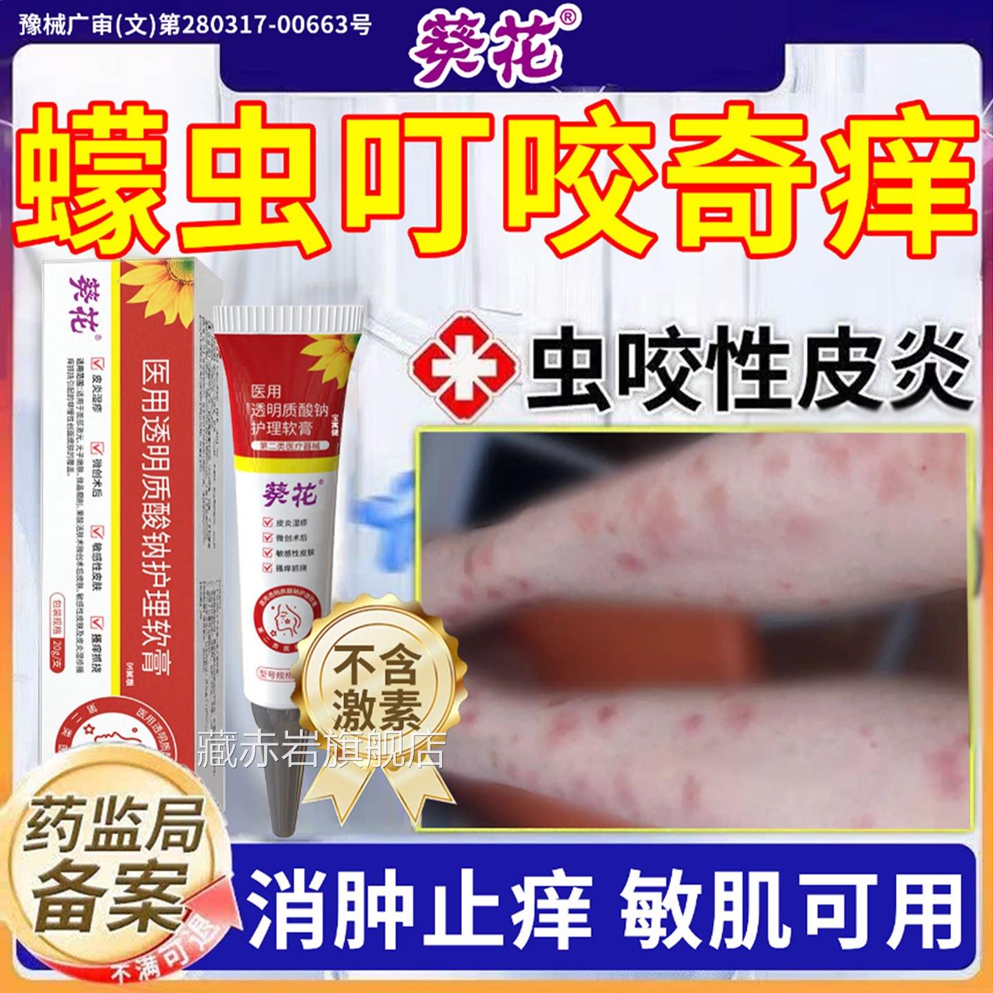 蠓虫咬伤止痒膏药蚊虫叮咬止瘙痒消肿防虫小咬性皮炎专红肿医用级