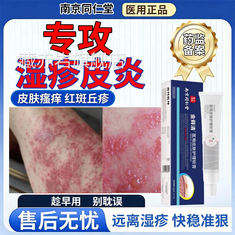 皮炎瘙痒湿止痒湿膏抗菌消炎角化型专用除湿止痒皮肤护理软膏颜慈