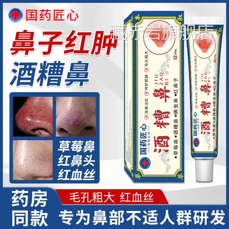 糟鼻酒草莓鼻修复药膏红鼻子鼻头红肿红血丝黑头玫瑰痤疮专特用效