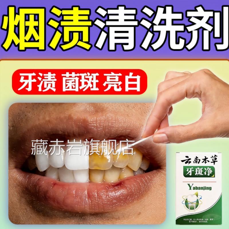 牙齿烟渍清洗剂强力污垢结石牙斑净速去黄去亮白院线型正品官方颜
