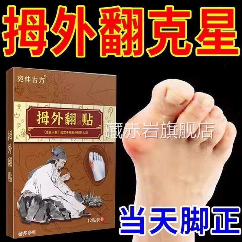 拇指外翻药膏贴拇囊炎疼痛大脚骨脚趾畸形肿胀正神矫器女克星神器