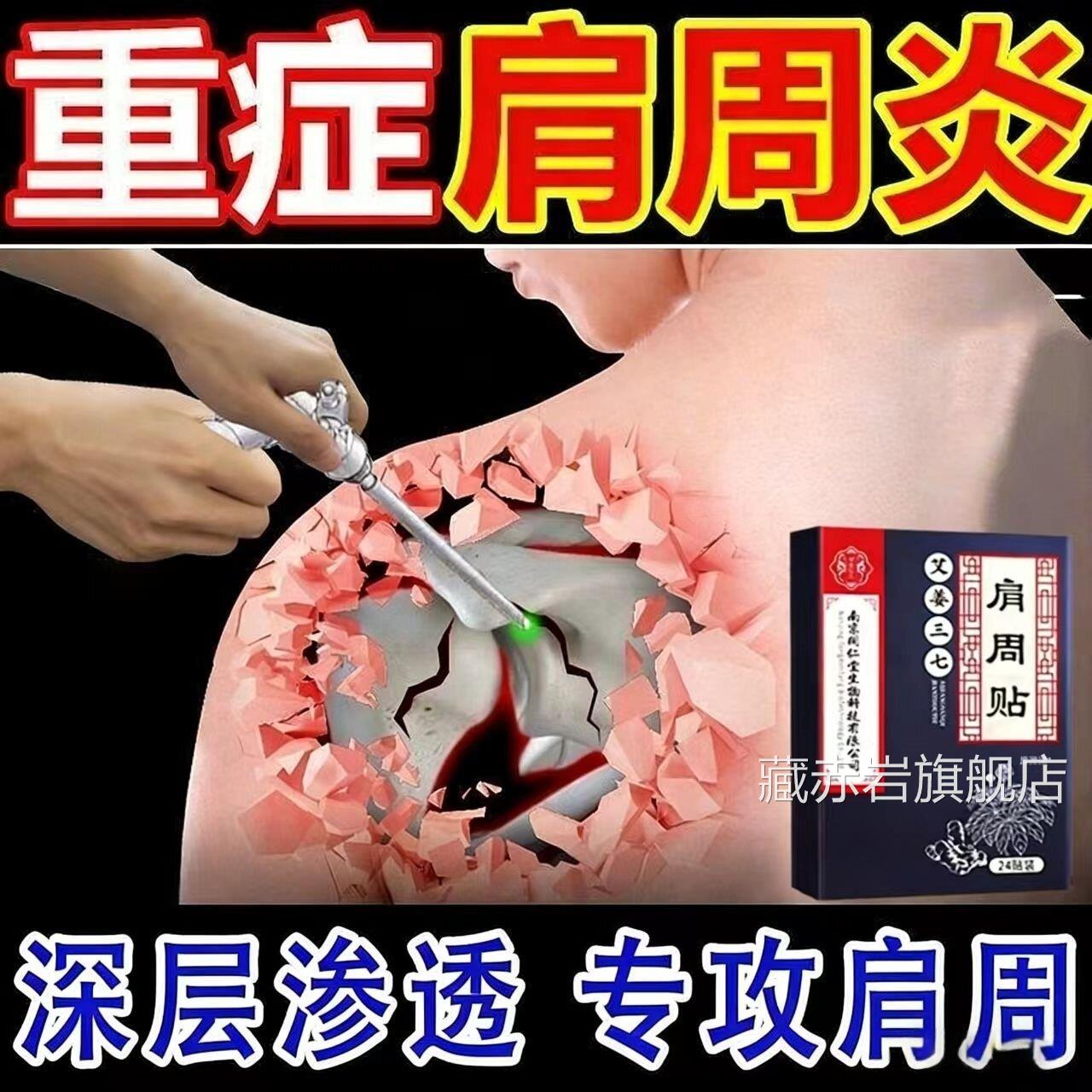 艾姜三七肩周炎专用贴膏肩膀酸痛贴抬不起胳膊治疗肩周正品热敷贴