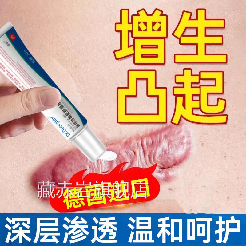 德国进口疤膏止痒软化乳膏手术祛烧伤增生凸起药膏祛疤凝胶正品颜