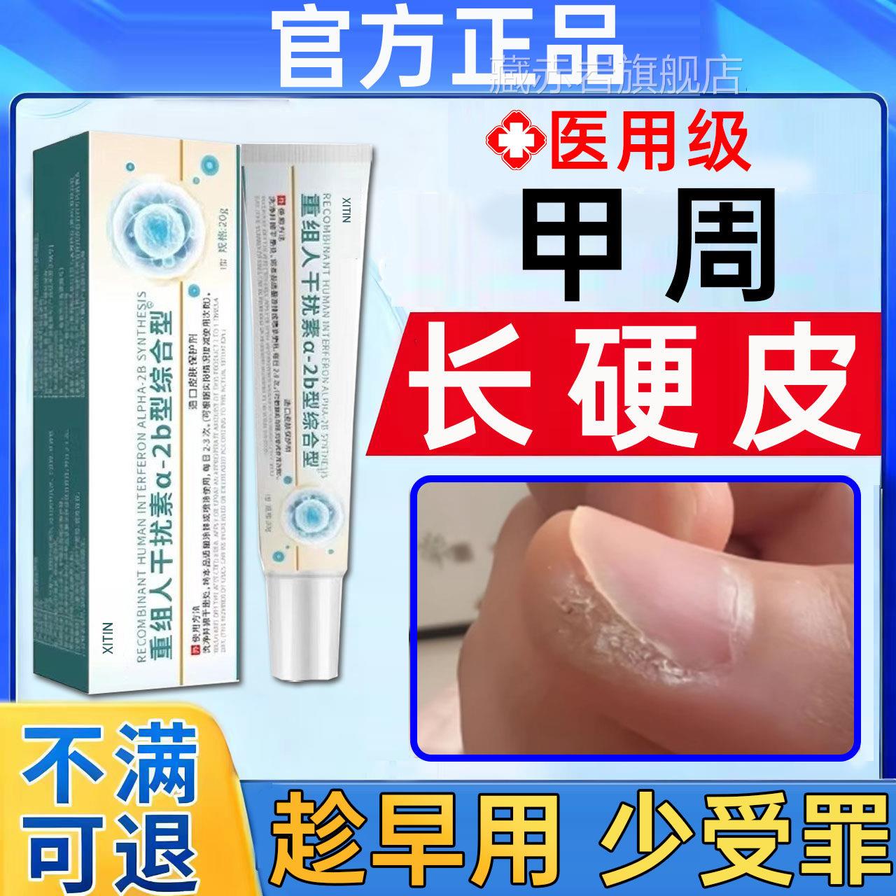 软化甲周硬皮去手指甲边缘死皮老硬茧除角质变硬专用修复凝胶去UU