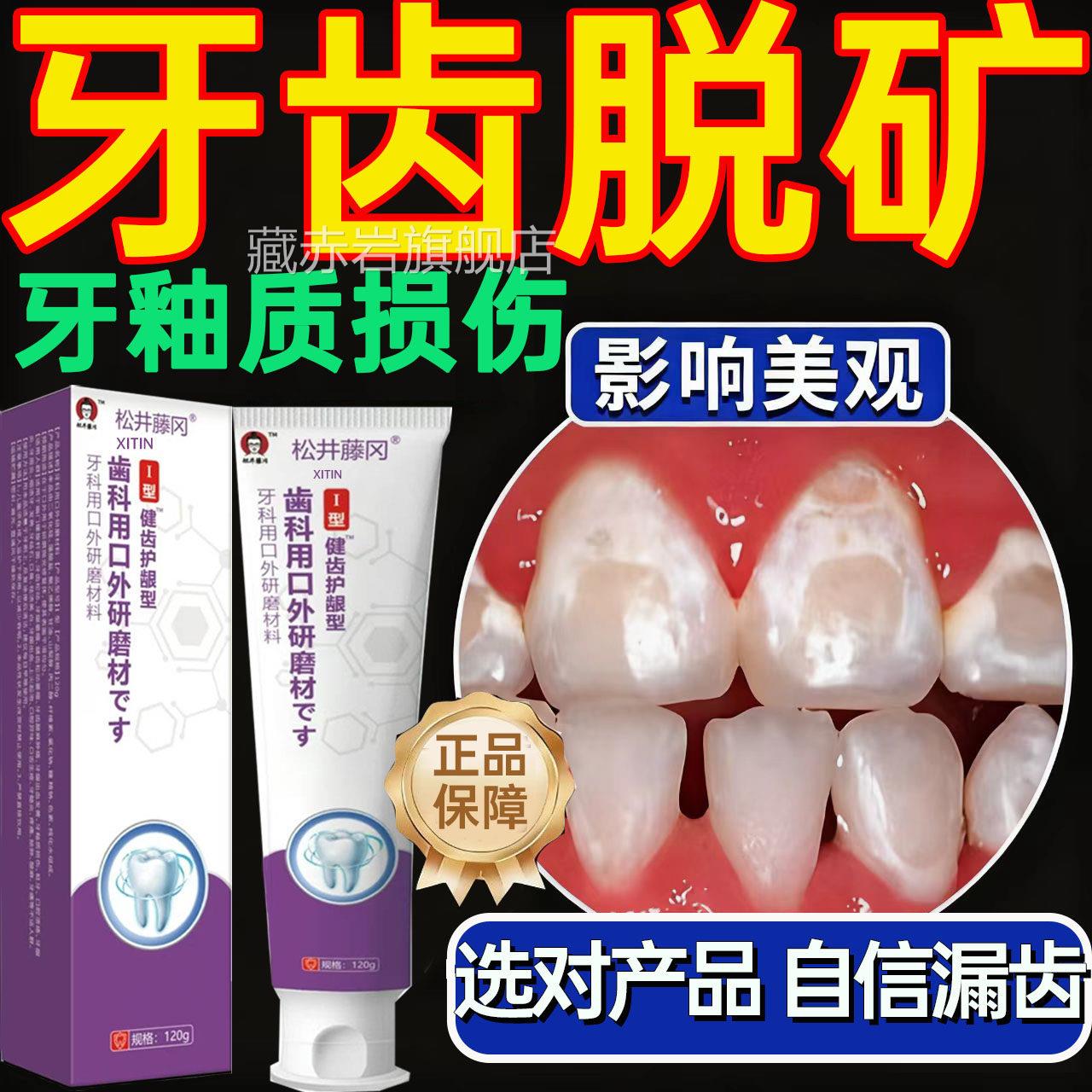 牙齿脱矿酸软牙釉质损伤白斑钙化含氟修复补矿再痛矿化专用牙膏UU