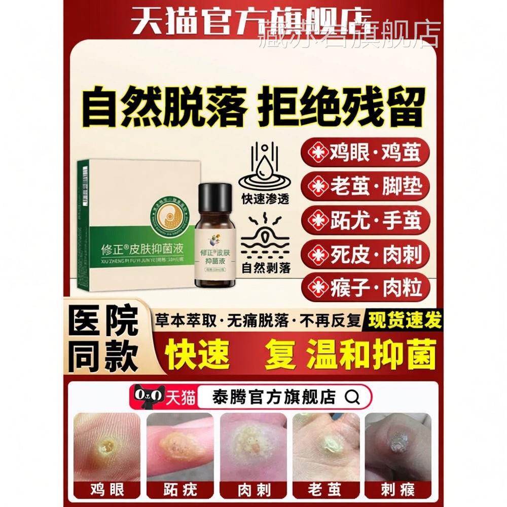 脩正清茧灵液鸡眼肉刺猴去除膏去脚底老茧死皮软化剂子祛手茧药贴