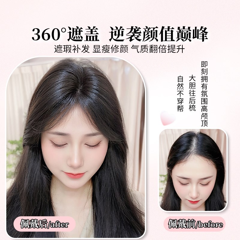 蕾丝手织不用戴发网假发女片头顶前额轻薄无痕自然蓬松真发补发片