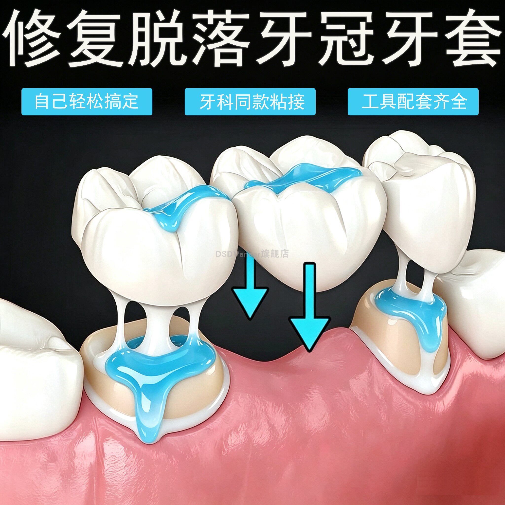 假牙粘合剂稳固医定用粘牙胶水自己粘烤瓷牙专用牙齿冠松动粘接剂