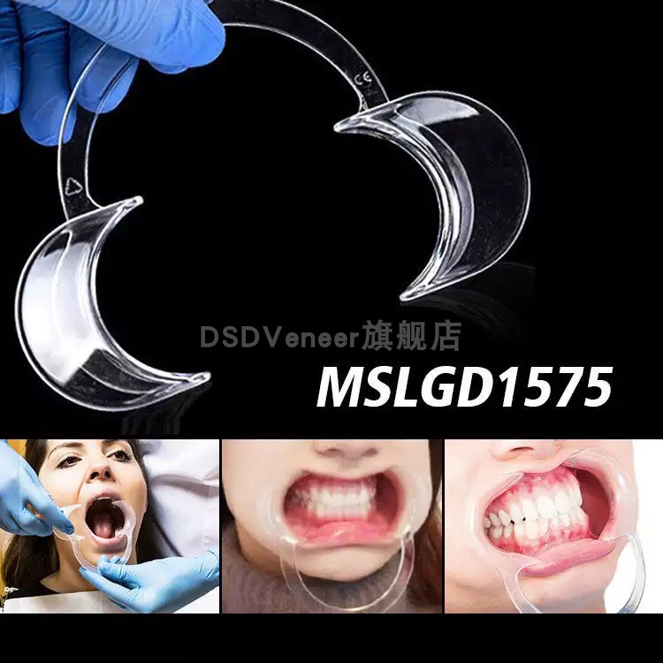 C型扩口开口器牙结石磨牙齿张嘴刷牙工具看牙透明撑开神器补牙器