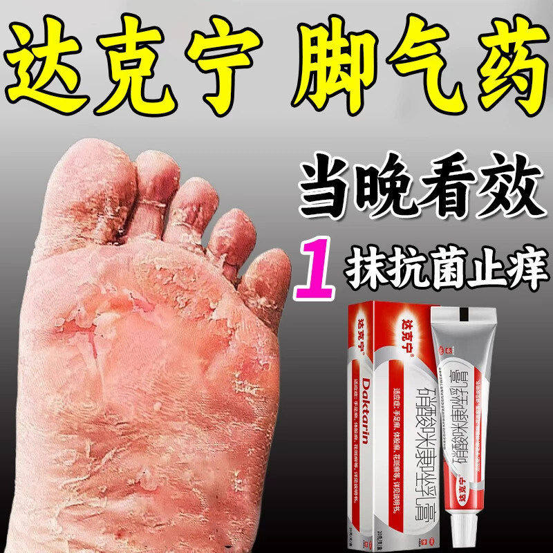 [达克宁]硝酸咪康唑乳膏2%*20g*1支/盒
