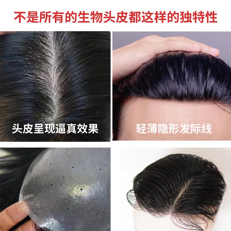 假发男士短发真发超薄生物头皮假发片可粘可卡前额隐形无痕补发