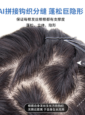 假发女头顶补发片蓬松增加发量新型时尚真发全真人发刘海假发片