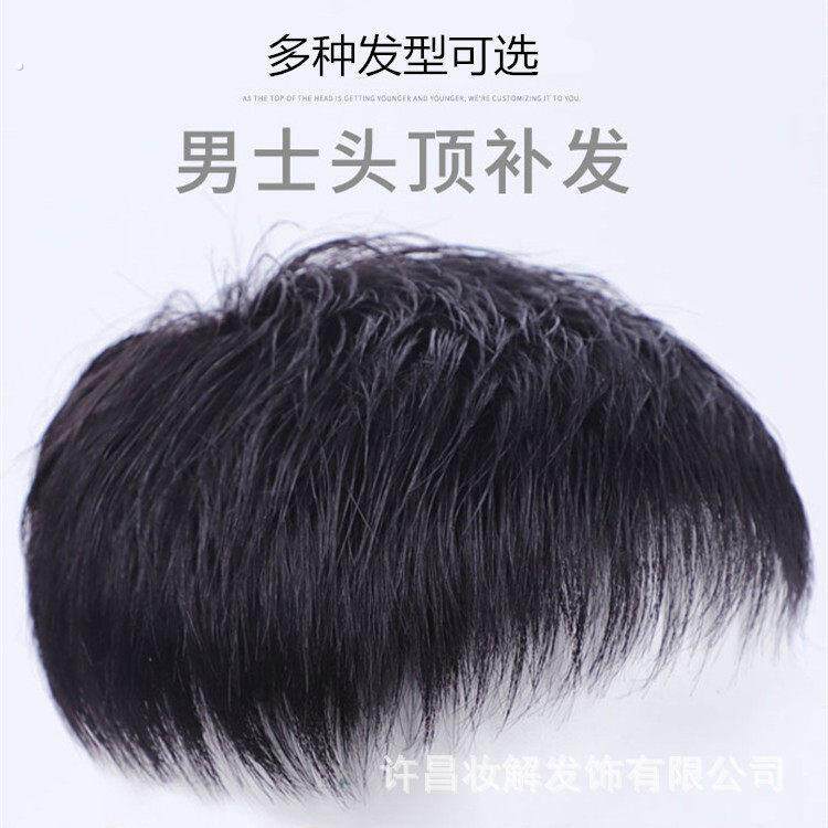 男士补发片假发男头顶补发前额秃顶补发垫接发翻盖假发真发男发块
