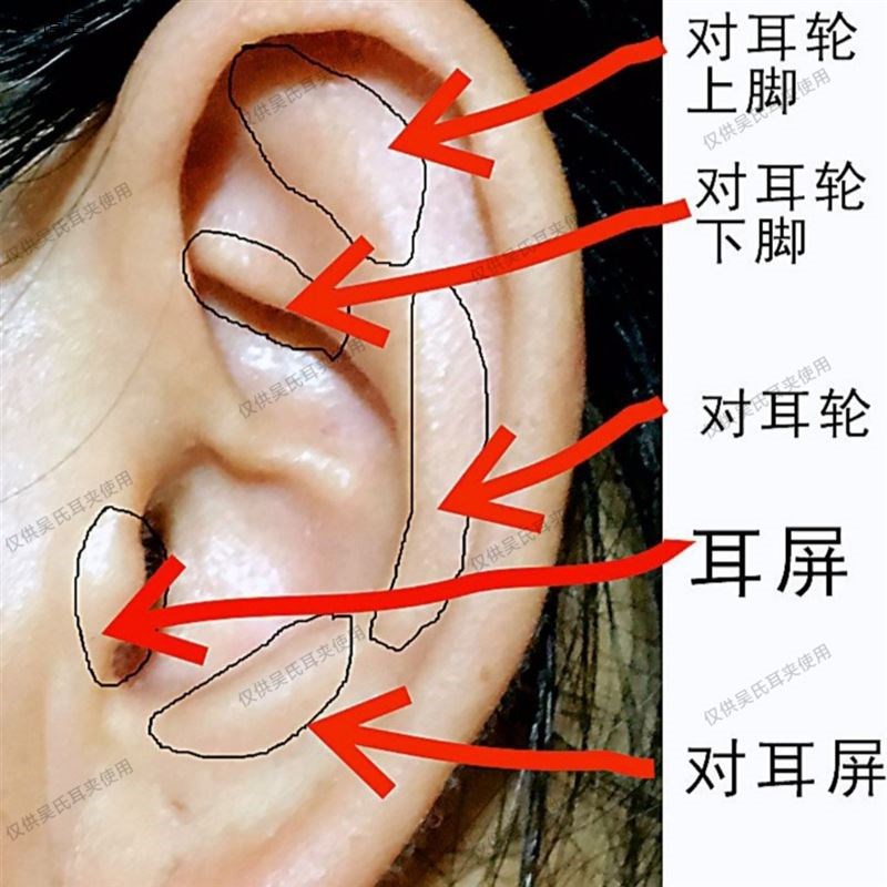 32只装吴氏耳穴夹夹子套装不锈钢弹簧主体亚光防滑家用