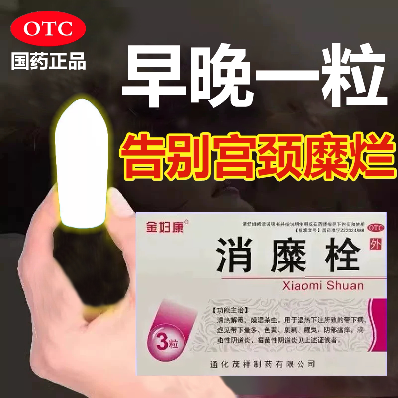 消糜栓阴道炎妇科用药宫颈炎症糜烂重度专用中药妇科凝胶消炎