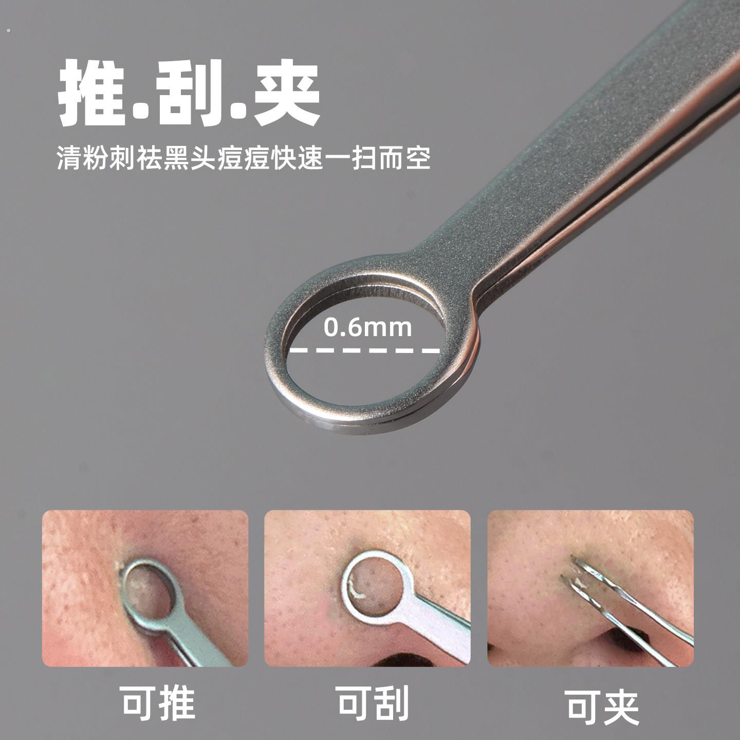 不锈钢环形黑头夹细胞夹粉刺圈刮黑头神器推挤痘痘粉刺夹美容工具