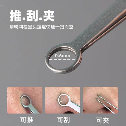 不锈钢环形黑头夹细胞夹粉刺圈刮黑头神器推挤痘痘粉刺夹美容工具