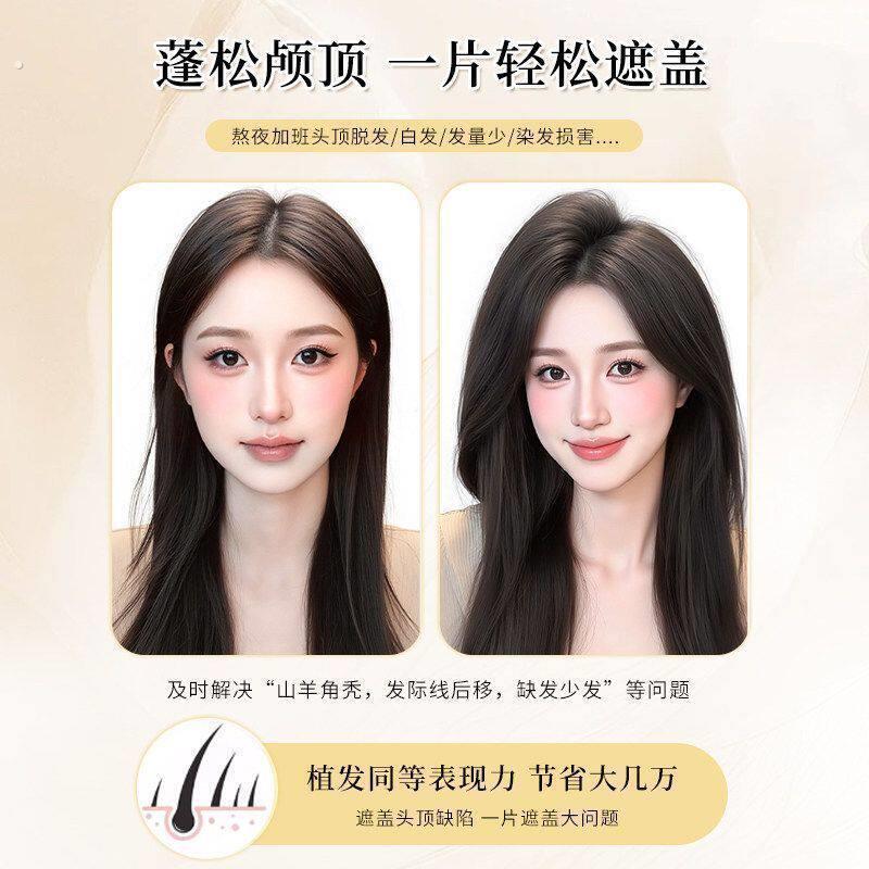 浏海假发女片头顶蓬松覆盖颅顶全真真发白发增发自然前额无痕补发